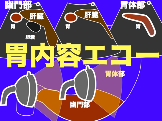 胃内容エコーアップ用.001.jpg