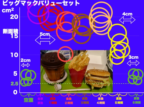 BigMac.042.jpg