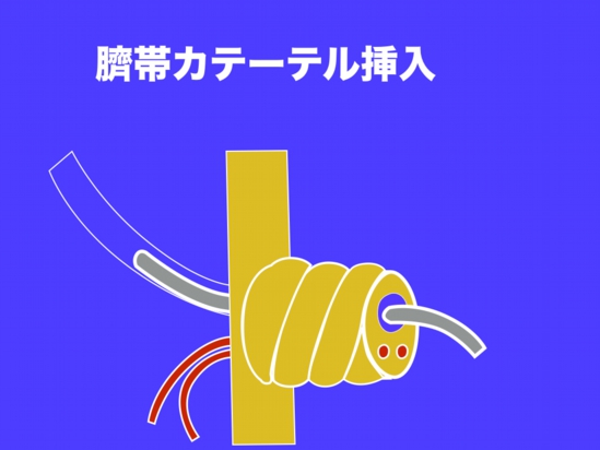 新生児心肺蘇生.001.jpg